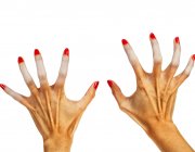 Se libérer du syndrome de Raynaud grâce à Pavlov ?