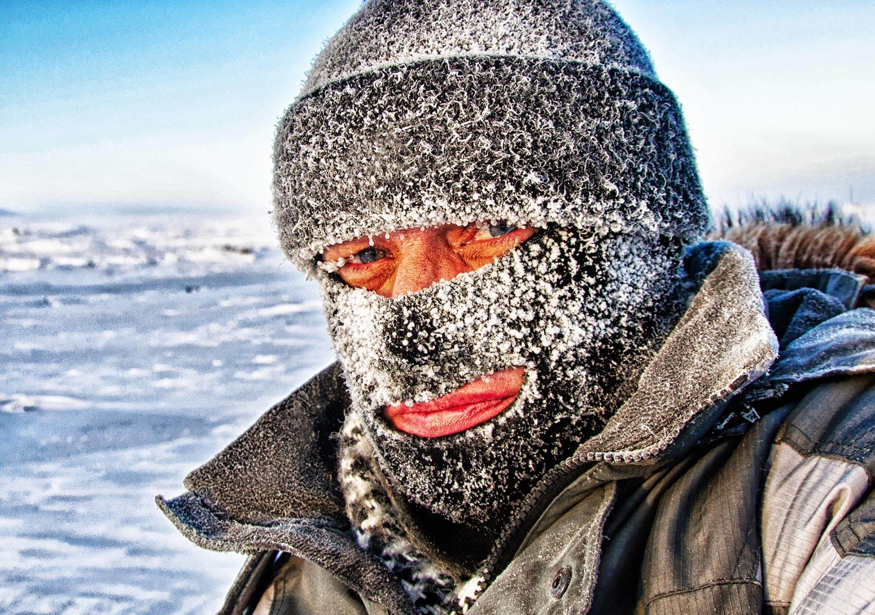 Brrrrr... hypothermie et engelures !