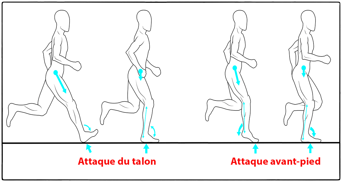 attaque